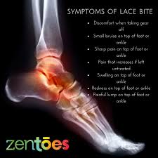 Pin On Ankle Protectors