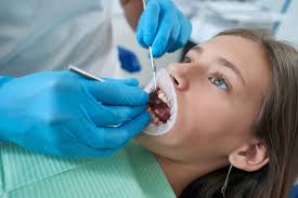 Porcelain Veneers Austin Tx