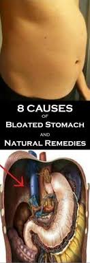 8 Causes Of Bloated Stomach And Natural Remedies Stomach Remedies Bloated Stomach Bloating Remedies