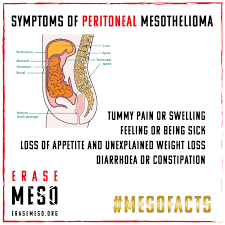 Many common symptoms are subtle and can be mistaken for other illnesses like the flu, irritable bowel syndrome (ibs), and celiac disease. Erasemeso On Twitter Mesofacts Symptoms Of Peritoneal Mesothelioma Asbestos Cancer Asbestosremoval Asbestos Mesothelioma Mesotheliomaawareness Erasemeso Https T Co Ia9ktpgv29