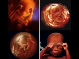 Como Esta Mi Bebe De 5 Meses De Embarazo Que Es El Entorpercimiento Criptico Naranjas Me Di Cuenta De Que Estaba En Estado De Buena Esperanza Hasta Que Pari A Mi Crio