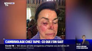 Frappés, ligotés et cambriolés : Bernard Tapie Et Sa Femme Dominique Les Images Choc De Leurs Visages Frappes Par Des Cambrioleurs Gala