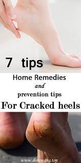 Look for thick moisturizers (eucerin, cetaphil, others). 7 Home Remedies For Cracked Heels And Prevention Tips Dorawang Blog