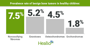 Several types of cancer, including multiple myeloma, leukemia, and lymphoma, can develop in the bone marrow. Asymptomatic Children Had A 18 9 Prevalence Of Benign Bone Tumors