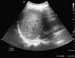 Image result for Ultrasound