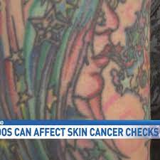 Tattooing has risen in popularity, but can this body art increase the risk of cancer? Tattoos Can Affect Skin Cancer Checks Woai