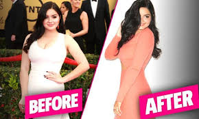 Pin On Celebrity Plastic Surgery