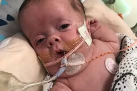 Baby Born with Dwarfism Heads Home After 6 Months