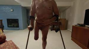 Polio Amputee Cripple Shows Off Deformed Body - ThisVid.com