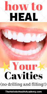 Heal Your Cavities By Changing Your Diet Stop Drilling And Filling Remineralize Your Teeth Holistic Dentistry In 2020 Holistic Dentistry Heal Cavities Teeth Health