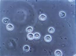 Images of e.coli bacteria, identification and treatment of e.coli infections, susceptibility of escherichia coli to antibiotics. Urineweginfectie Wikipedia
