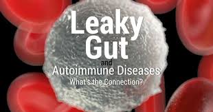 Leaky Gut And Autoimmune Diseases What S The Connection Autoimmune Disease Heal Leaky Gut Leaky Gut