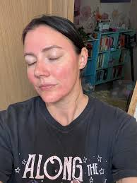 No perfect skin here. I have acne and wrinkles and fight the urge to get  Botox every single day. I want to embrace getting older but it's HARD when  the world suggests