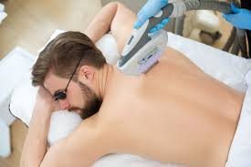 تجربتي مع إزالة الشعر بالليزر للرجال تجربتي