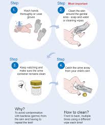 Image result for Clean Catch Urine Collection