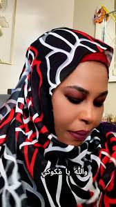 حادث ولدي وقطعوا رجلو.. صراع أم سودانية وسط الغربة والعلاج الغالي!