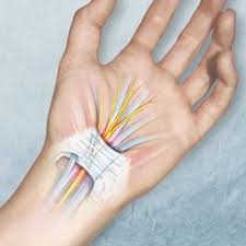 почему немеют конечности рук и ног во время сна Nemeyut Ruki Pochemu Eto Proishodit I Chto Delat Uprazhneniya Dlya Shei Zdorove Zdorove I Krasota