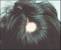 Alopecia Female