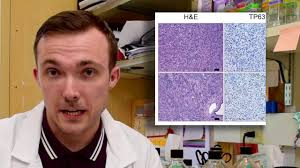 Pancreatic cancer's addiction could be its end