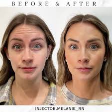 ᴍᴇʟᴀɴɪᴇ ᴛᴜᴇɴɪ ʙꜱɴ, ʀɴ