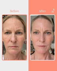 Has anyone tried the Effol regrowth serum? What's it like? Any reviews?