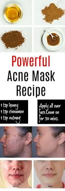 Home Remedies For Pimples And Blackheads For Oily Skin Best Home Remedy For Acne Overnight Homemad Natural Acne Mask Home Remedies For Pimples Natural Acne