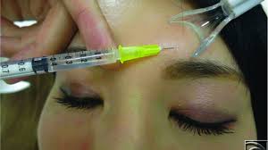Image result for Botulinum Toxin Injection