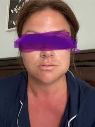 Friday even I had a minor tooth ache and didn't think much of it, but that  night I was in excruciating pain that did not subside with ibuprofen.  Saturday morning I had