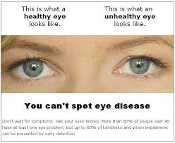 Eye Diseases Google Search Eye Health Eyes Eye Care
