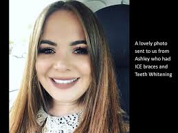 Patient Testimonials and Reviews