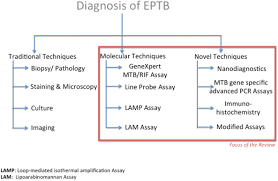 Image result for Extrapulmonary Tuberculosis