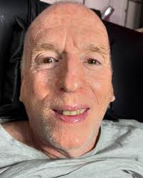 ME COSTO MUCHO HACER ESTE SEPTUM POR LA COLUMELA DESVIADA 🌸 Pero se logró  pronto regresará para expandirlo 🤓 By @angel.alanis.1088 RECUERDA ESTAMOS  EN JUÁREZ 62 b sur colonia centro a media