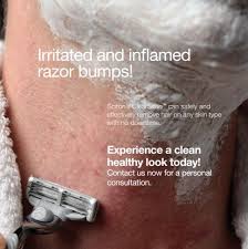 Our laser treatments work in an average of six sessions and are a simple way to keep facial skin smooth and hair free; Laser Hair Removal Denver Co Highlands Ranch Laser Hair Removal