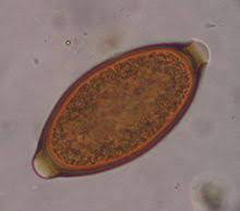 Maybe you would like to learn more about one of these? Trichuris Vulpis Wikipedia
