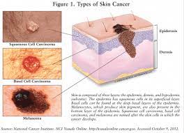 skin cancer is by far the most common type of cancer. Pin On Anti Aging Treatment