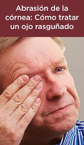 Abrasion De La Cornea Como Tratar Un Ojo Que Ha Sido Rasgunado Dia De La Salud La Cornea Enfermedades Del Ojo