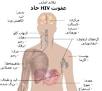 نتیجه تصویری برای ‫مقاله و عکس درباره بیماری ایدز pdf‬‎