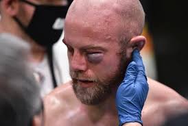 UFC Fight Night 184: Justin Jaynes suffers nasty eye injury, which ends  fight vs. Devonte Smith