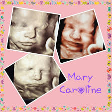 Thank you Kelsey Mason for allowing us the opportunity to peek in