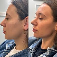 Exploring Life & Business with Robyn of Luna Skin and Aesthetics