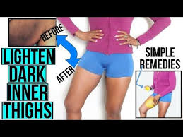 How To Lighten Dark Inner Thighs Fast And Naturally Youtube Lighten Inner Thighs Lighten Skin Skin Lightening Cream