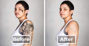 Several types of providers or businesses offer laser treatments, including: 9 Ex Gang Members With Their Tattoos Removed Bored Panda