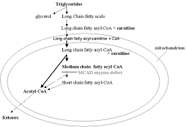 Image result for MCAD Deficiency