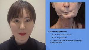 Plastic and Reconstructive Surgery