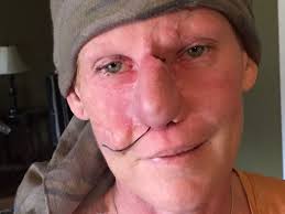 Fundraiser by Tracy Donhauser : Road to Recovery for Connie