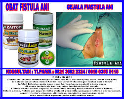 Penyebab yang paling sering terjadi adalah karena feses yang besar dan keras yang keluar melalui anus. Obat Fistula Ani Generik Dijual Di Apotik Kimia Farma Bukalapakshop