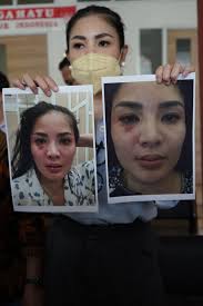 Gugatan bernomor 230/pdt.g/2021/pa.js tersebut mencantumkan nama nindy ayunda sebagai penggugat dan askara. Nindy Ayunda Sebut Suaminya Selingkuh Sejak Tahun 2015 Kumparan Com