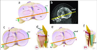 The human body is shown in anatomical position in an (a) anterior view and a (b) posterior view. Anatomical Topography Of A Split Wedge Fracture Describing Modified Download Scientific Diagram