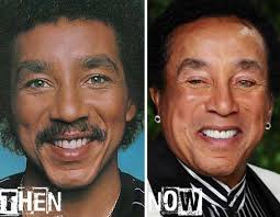 Smokey Robinson Celebrity Surgery Celebrity Plastic Surgery Plastic Surgery
