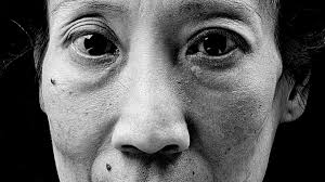 Dem Tod ins Auge geblickt